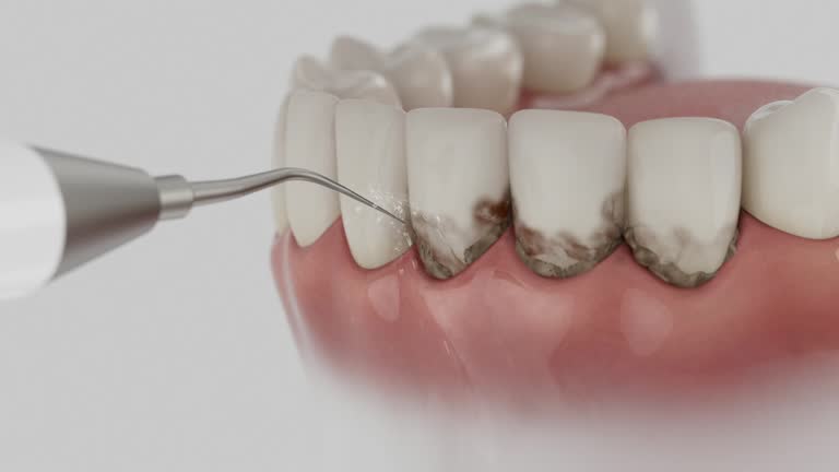 Trusted Teeth Cleaning And Checkup service in Somerville, TX - Dentist Open Now